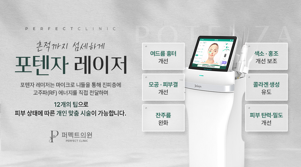 포텐자 도입